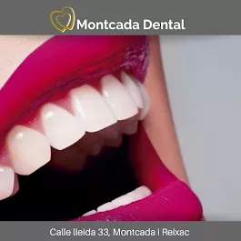 blanqueamiento dental montcada dental