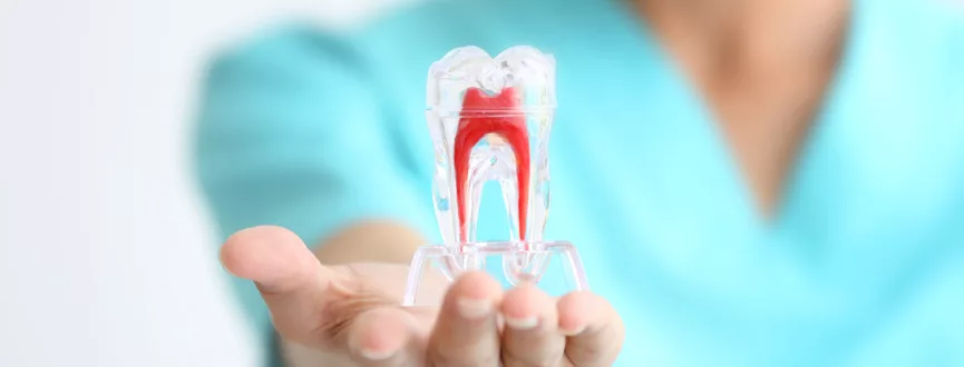 endodoncia